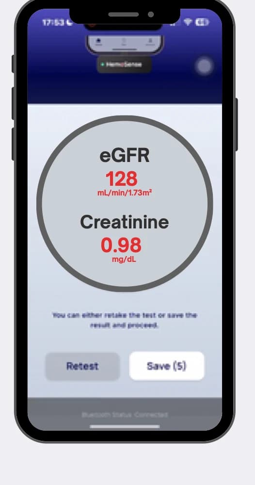 Example creatinine and eGFR result in the NeoDocs app