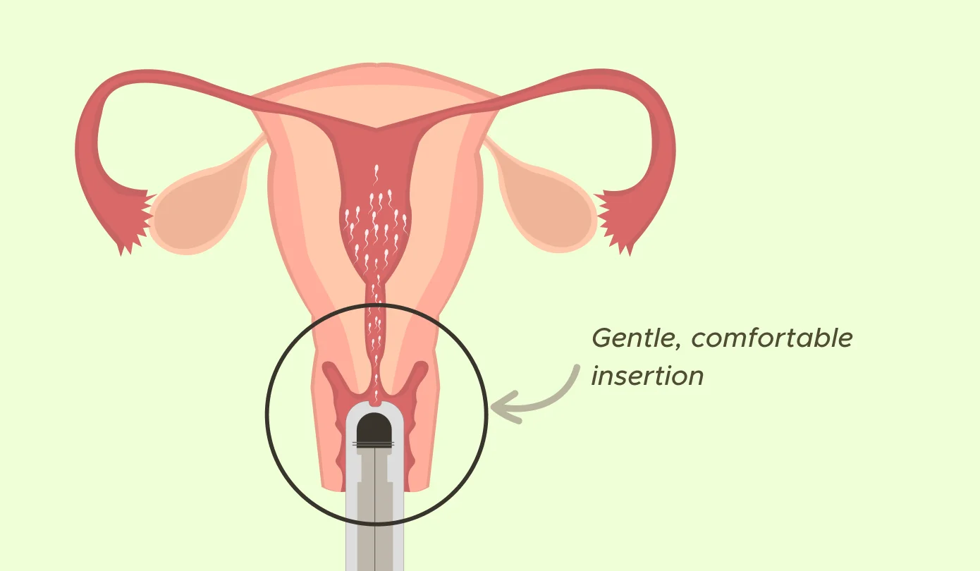 Medical diagram showing reproductive anatomy